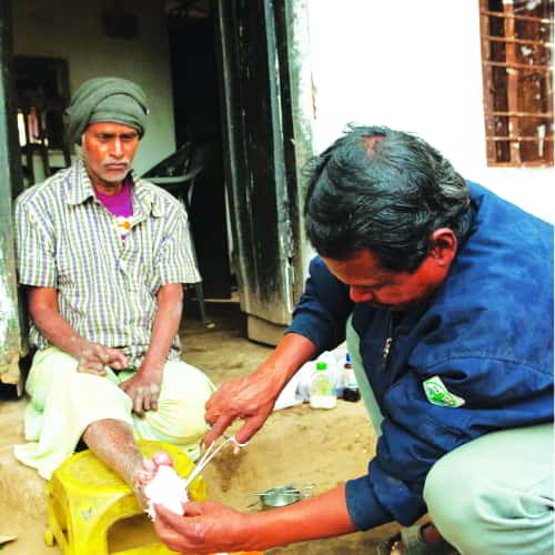 GFA-supported leprosy ministry, Sisters of Compassion, and other national workers are ministering to the needs of leprosy patients in Asia, bestowing dignity to those whom others have rejected
