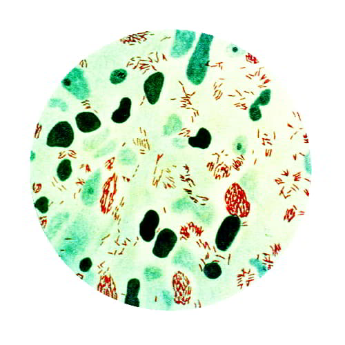 Illustration of Mycobacterium leprae bacteria, the cause of leprosy in humans