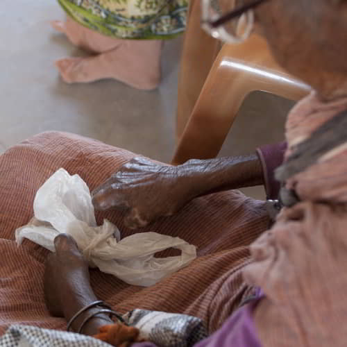 Elderly leprosy patient woman in poverty