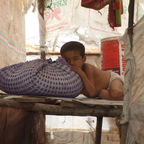 Young malnourished child in poverty